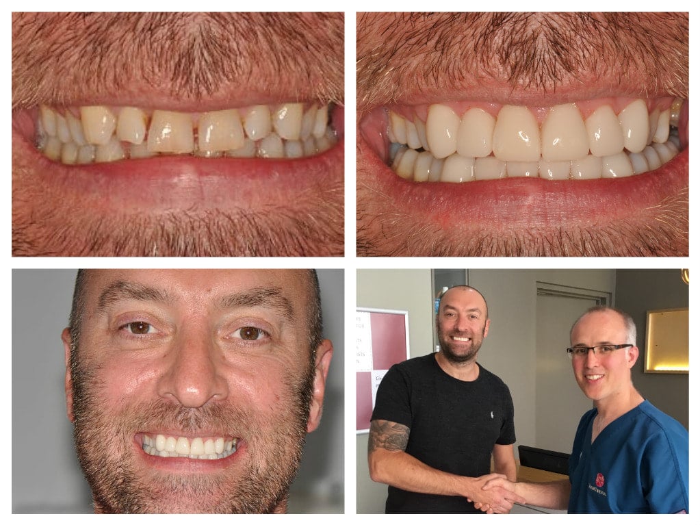 Heath Dental in Dickens Heath, Shirley, Solihull