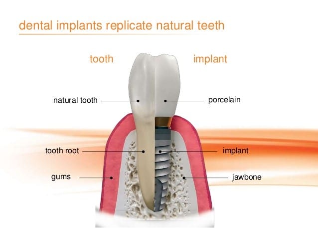 Heath Dental in Dickens Heath, Shirley, Solihull